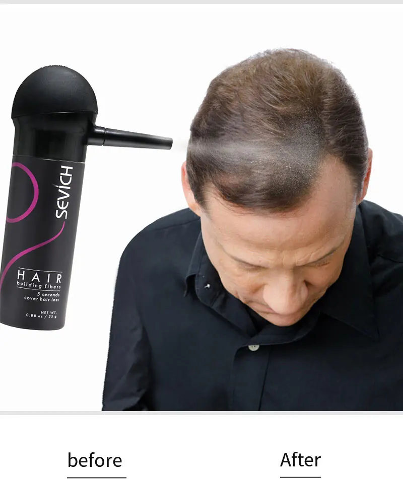 Кератиновые порошки для волос, спрей-аппликатор, насадка, насос для волос, волокно, спрей-гель, 12 г, 25 г, удобный инструмент для использования
