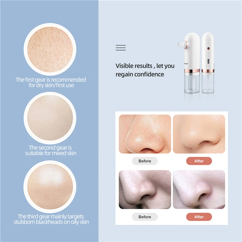 

CkeyiN Electric Small Bubble Blackhead Remover Water Circulation Moisturizing Vacuum Suction Pore Cleaner Acne Pimple Removal 51