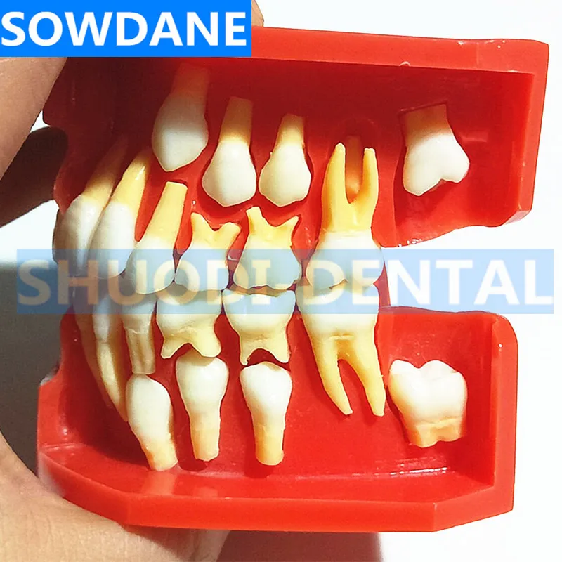 Стоматологическая детская модель выпадающих зубов сменная постоянные зубы