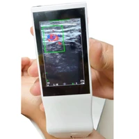 teveik 11 years wifi ultrasonic convex probe portable ultrasound scanner laptop probe