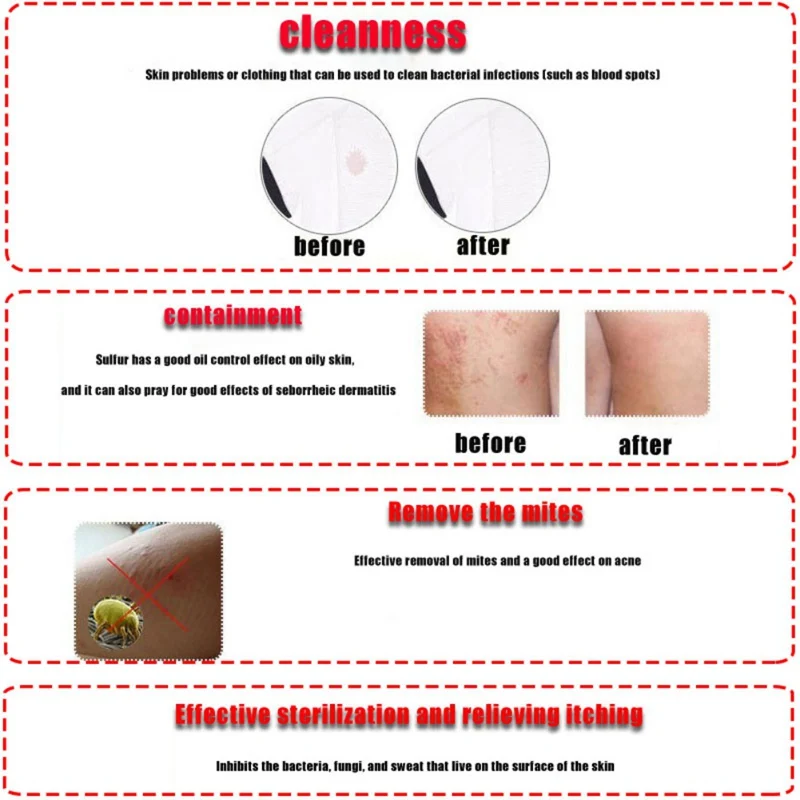 Anti-acne Anti-mites Soap Cleaning Pores Body Cleansing Soap for Face Wash Bath Skin Care Sulfur Soap Control Oil Soap Hot Sale