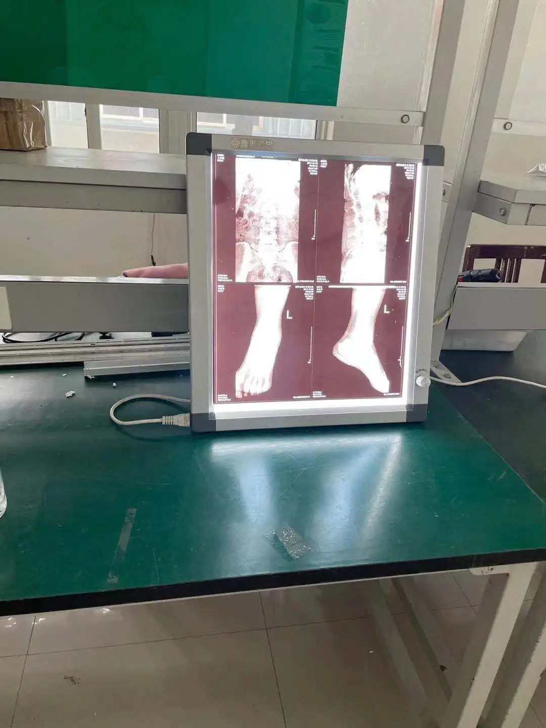 Ультратонкий 21 мм Медицинский СВЕТОДИОДНЫЙ рентгеновский видоискатель