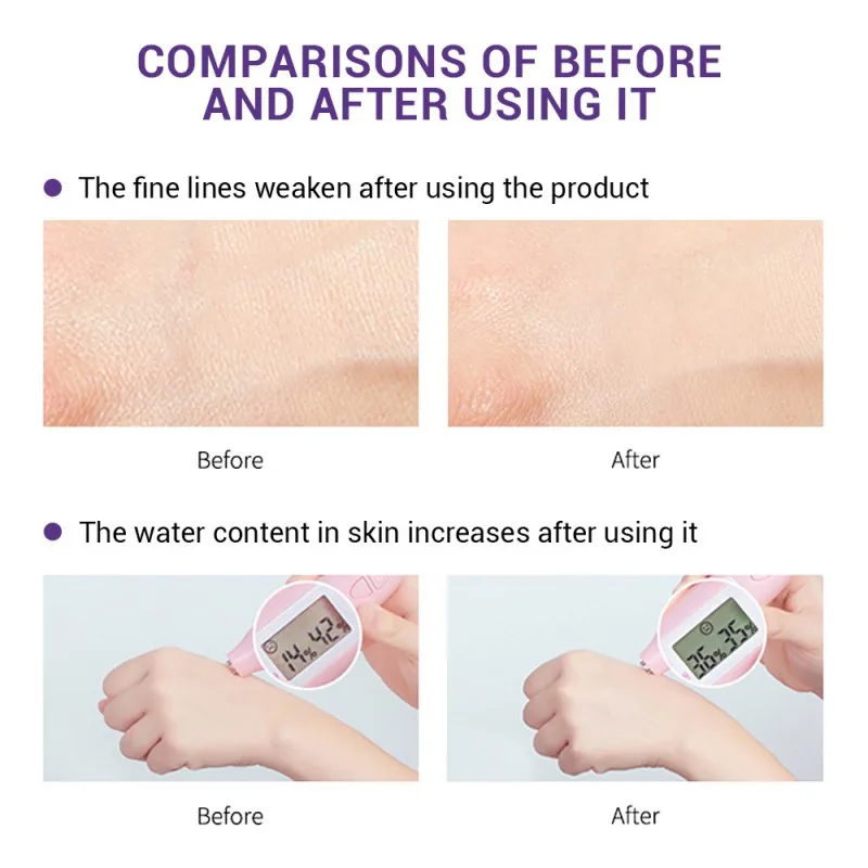 New Blueberry Hyaluronic Acid Serum Essence Oil Moisturizing Reduces Fine lines Whitening Anti-Aging Anti Wrinkle Skin Care |