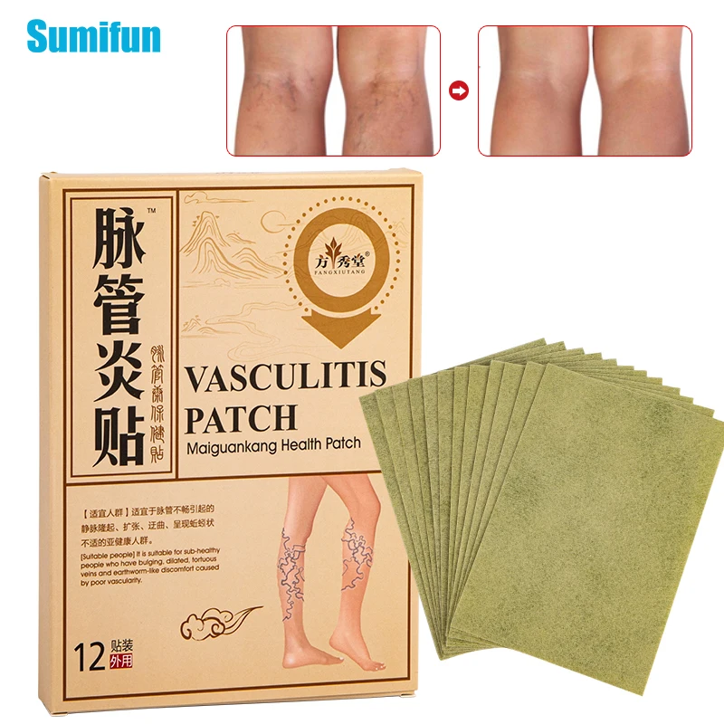 

12Pcs Herbal Varicose Veins Medical Plaster Anti-swelling Leg Vasculitis Phlebitis Removal Spider Angiitis Health Care Patch