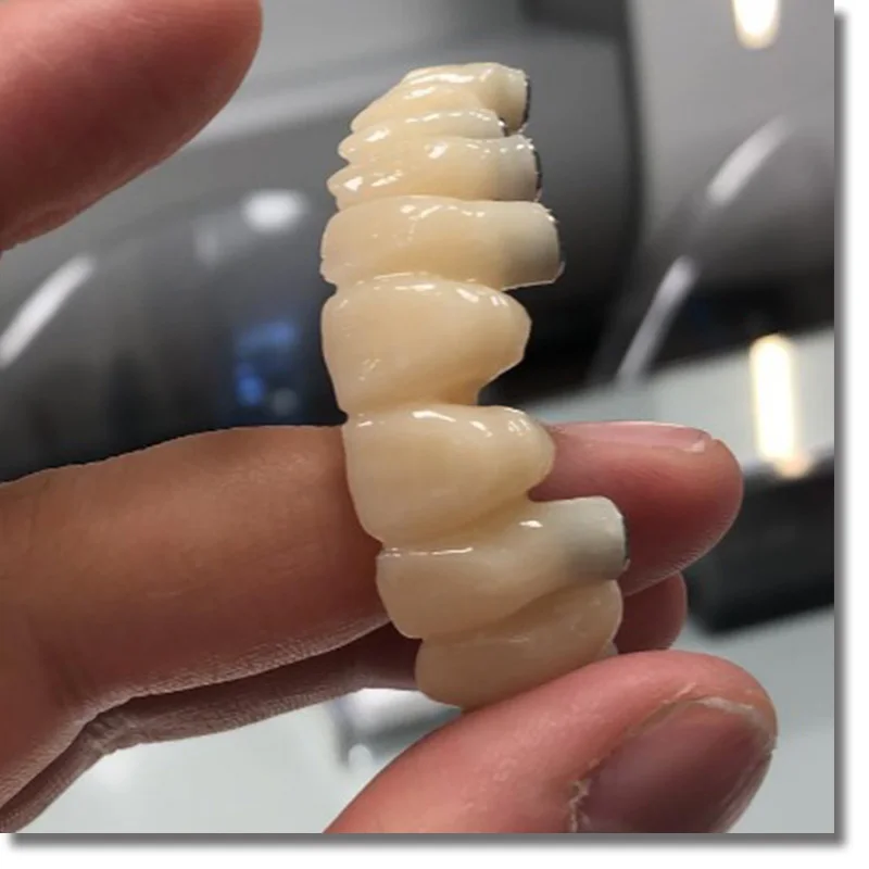 Стоматологические патроны PMMA 654022 мм 2 шт. 20 цветов|Отбеливание зубов| |