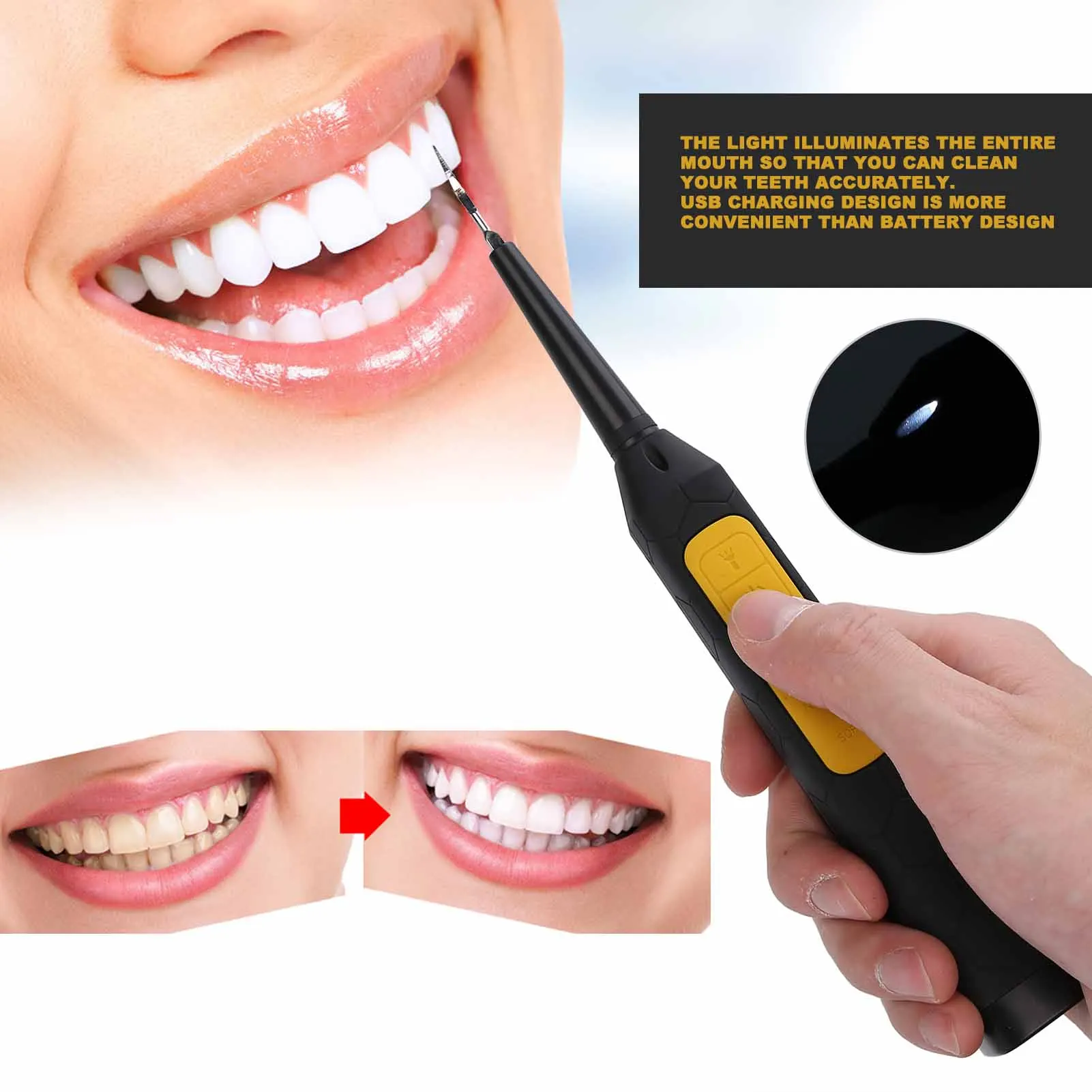 

1 шт., Usb-зарядка, бытовой ультразвуковой прибор для чистки зубов