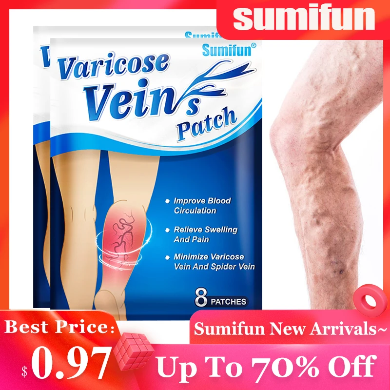

8Pcs Only$1.03 Sumifun New Varicose Veins Patch Phlebitis Vasculitis Treatment Sticker Thigh Spider Removal Pain Relief Plaster