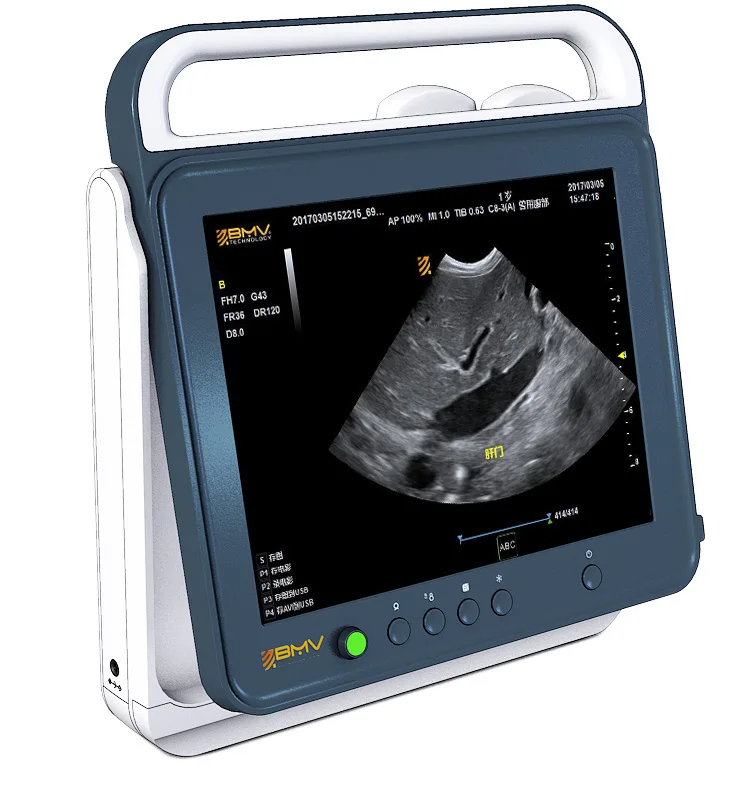 Laptop Ultrasound machine/ Vet Ultrasound machine /Vet Handheld Ultrasound Scanner