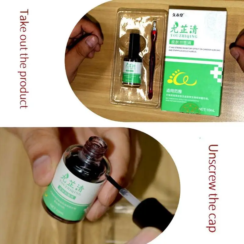 Nail Fungal Cure Nails Fungus Wart Removal Liquid Nutritious Anti Paronychia Onychomycosis Foot Repair 10ml | Красота и здоровье