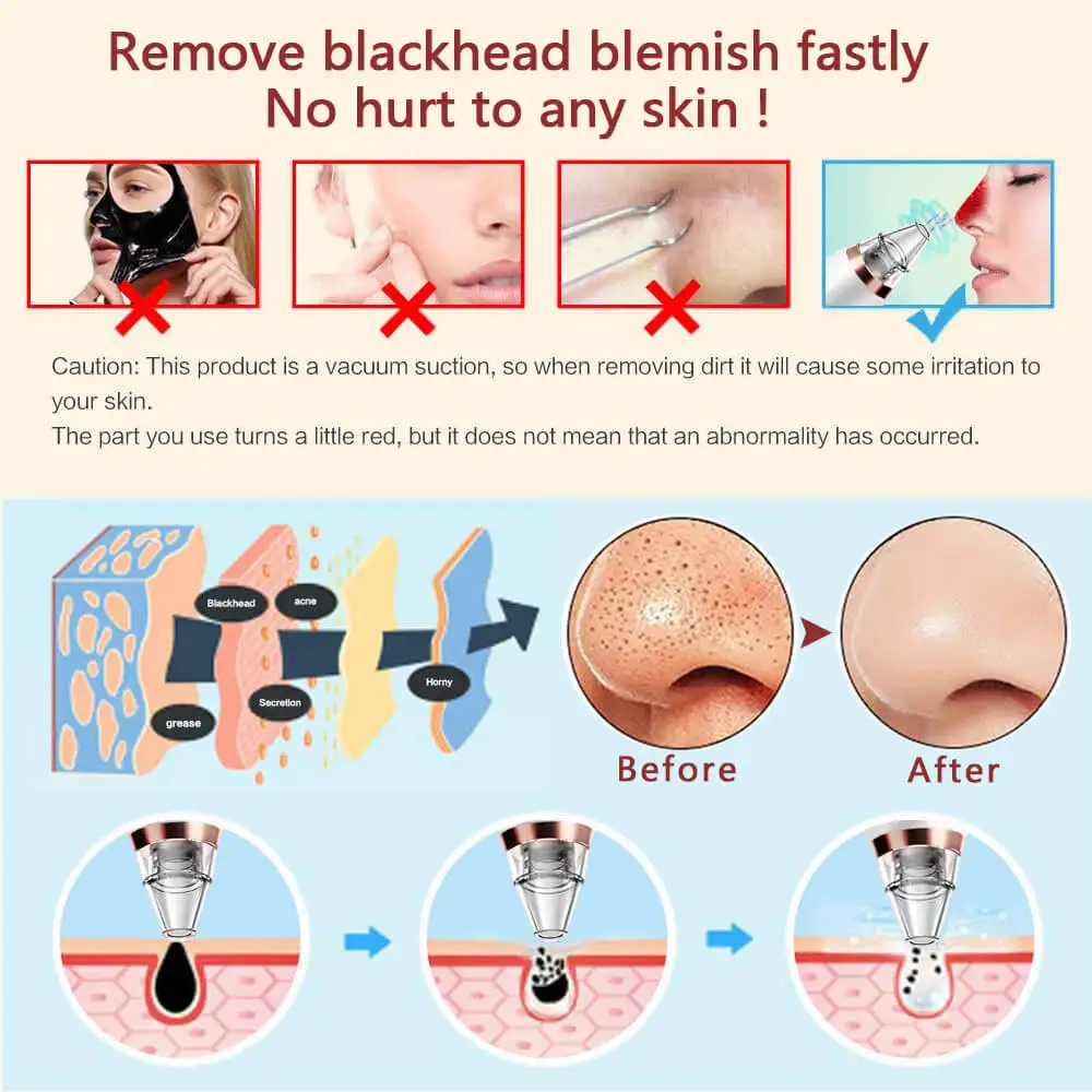 Мощный угорь Вакуумный Очиститель черных точек уход за кожей лица Уход