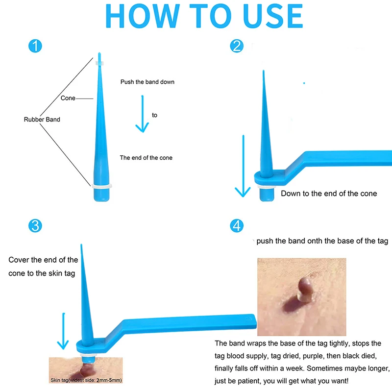 Взрослый Micro группа нетоксичные Уход за лицом моль для борьбы с пигментацией