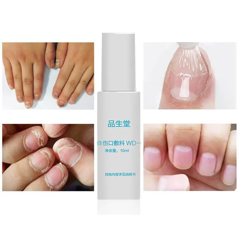 Средство для ухода за ногтями антибактериальное средство дезинфекции ногтей