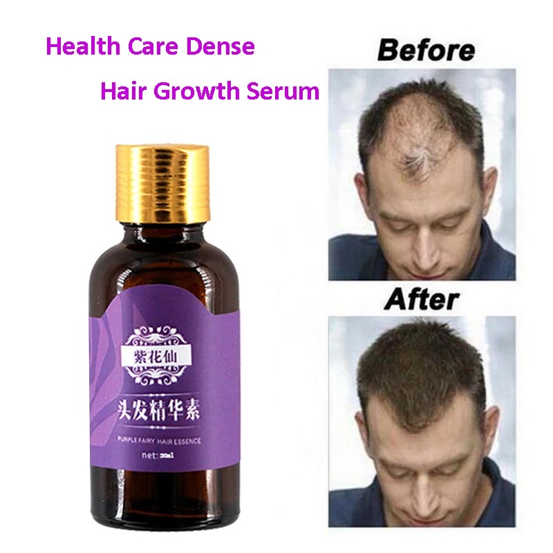 

20ml Fast Hair Growth Faster Grow Hair Regrowth For Men Women Pure Natural Hair Loss Products Pilatory Treatment Anti-Hair Loss