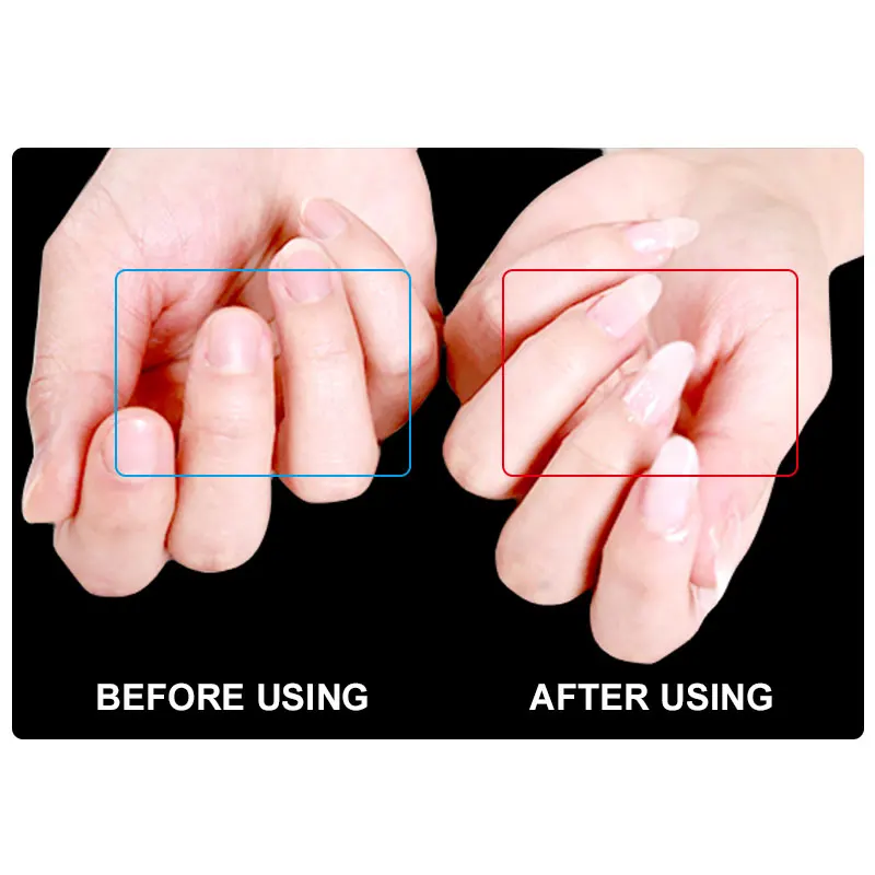 Гель-лак Ellwings для быстрого наращивания ногтей наборы УФ-гель белый розовый