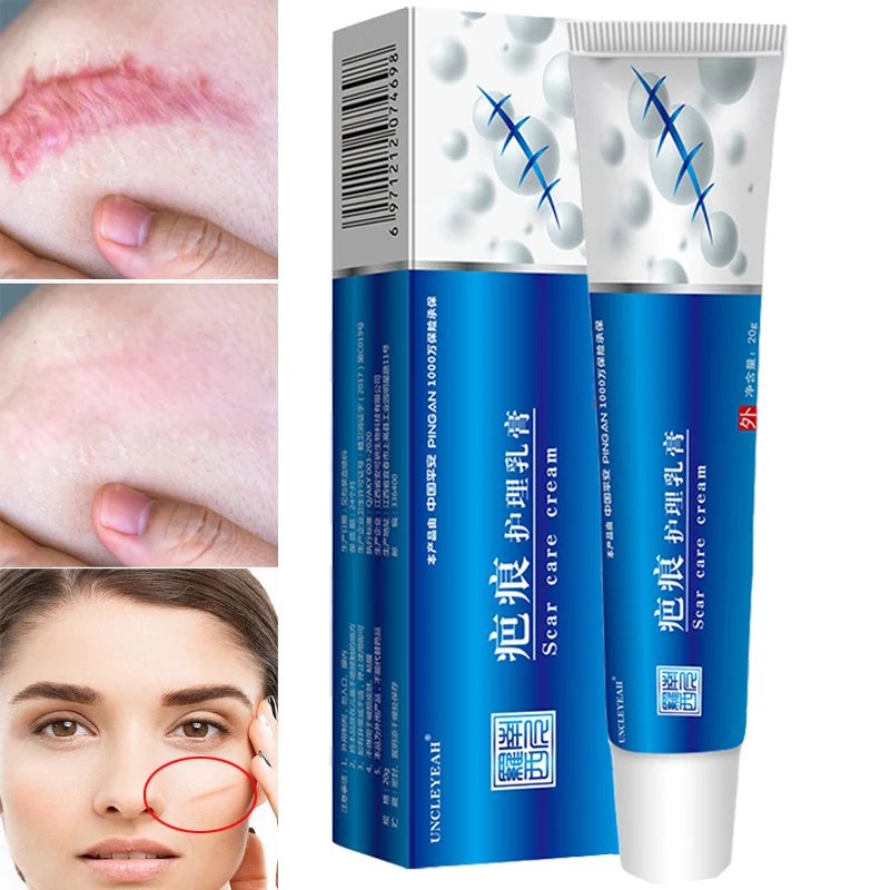 

Scar Removal Cream Acne Pimples Stretch Marks Face Gel Remove Acne Smoothing Whitening Moisturizing Body Repair Skin Care 20g