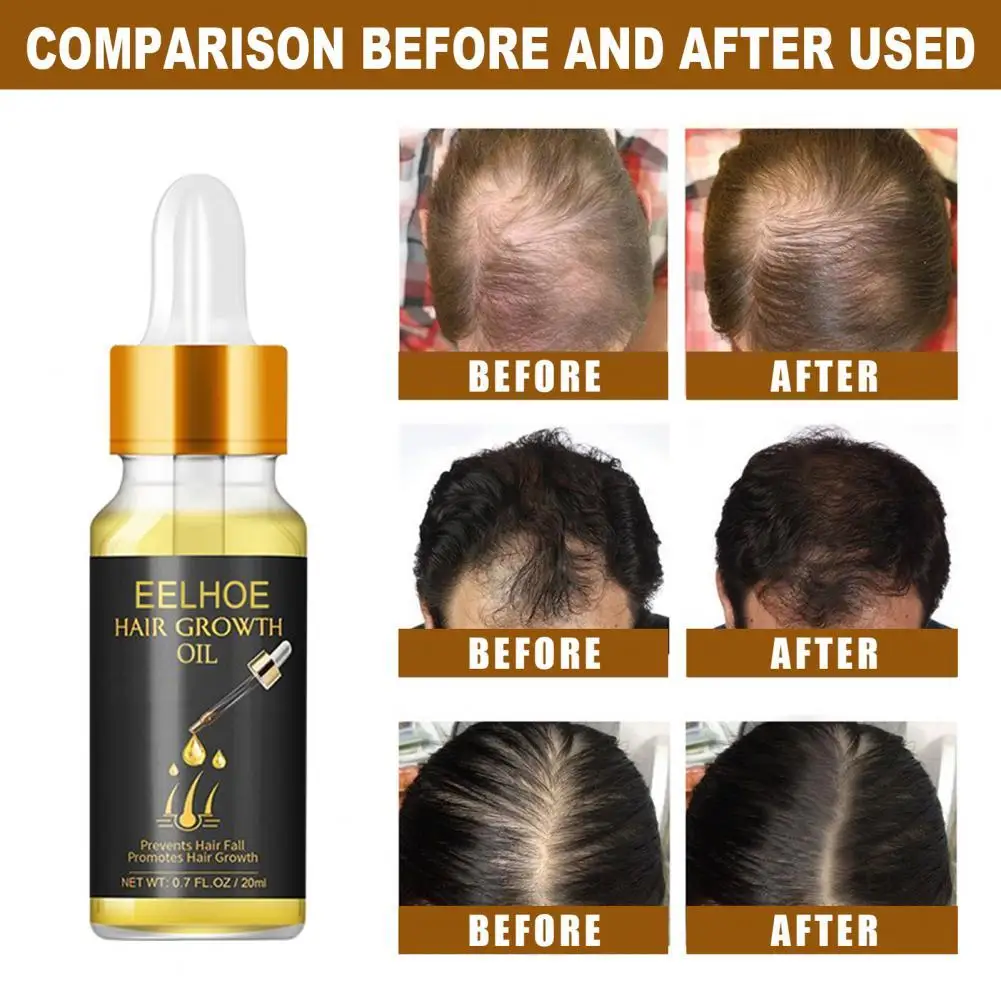 

Restore Luster Easy to Use Scalp Hair Conditioner Essential Oil for Women