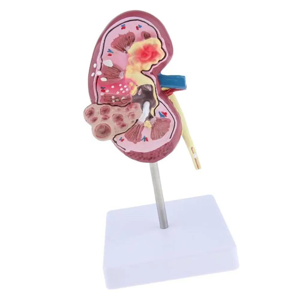 Медицинский орган почек анатомическая модель лезии анатомии человека учебные