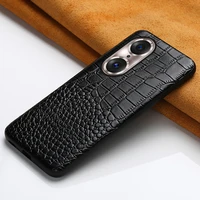 genuine leather cowhide case for honor 50 60 70 pro plus 10x lite 9x 8x note 10 magic 3 cover for 10i 20i 30 pro 20 pro 10 lite