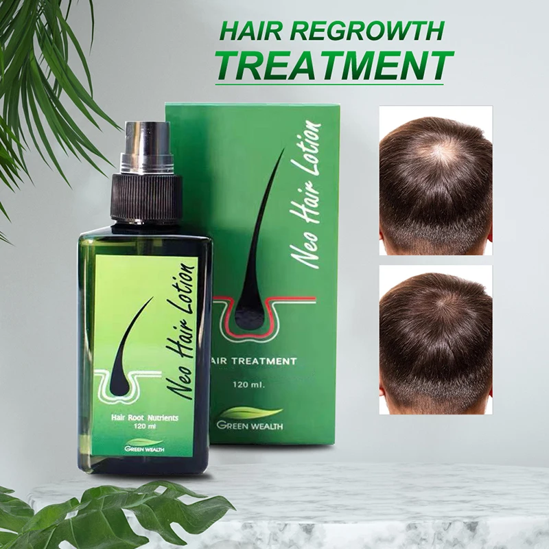 

Scalp Treatment Baldnes Anti-hair Loss Oil Thailand Hair Growth Serum Original Neo Hair Lotion for Women Men Beard Grow Products