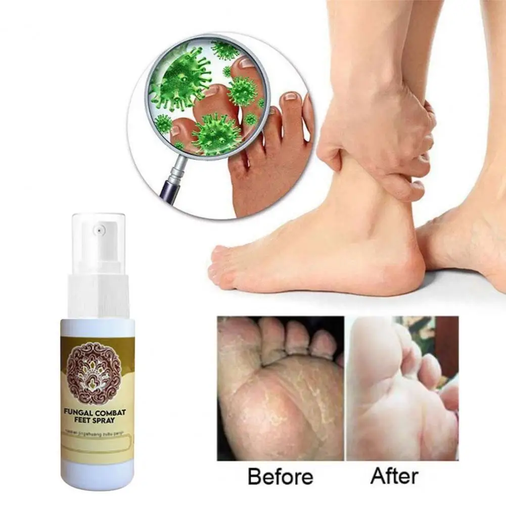 

60ml Feet Spray Non-irritating No Sting Skin Care Beriberi Itch Feet Deodorizer for Men Peeling Blisters Foot Deodorant Spray