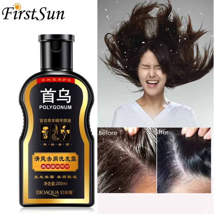200 мл шампунь Multiflorum Китайский травяной удаление перхоти против выпадения волос