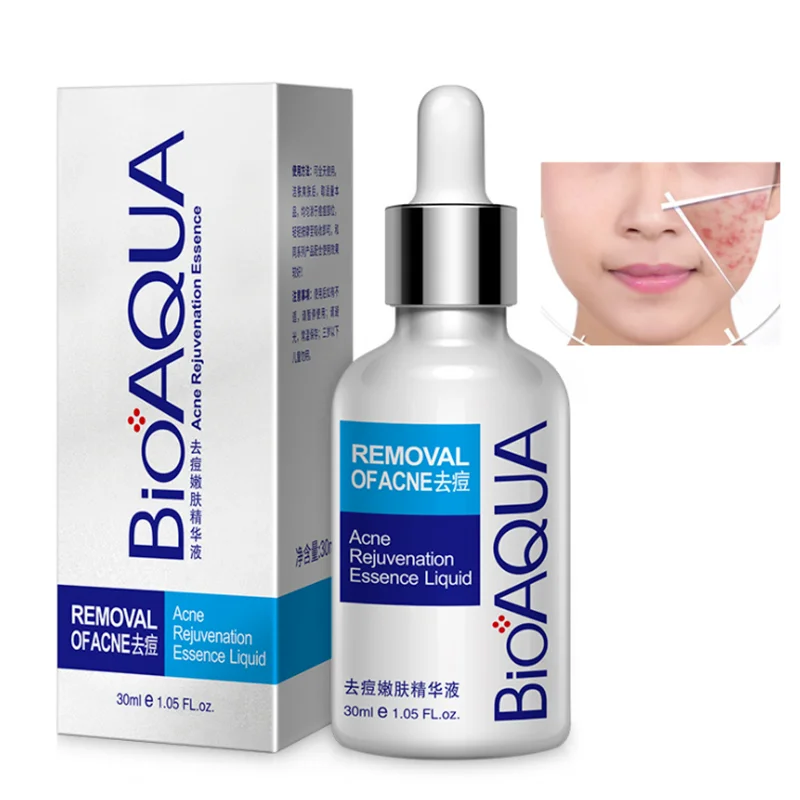 

BIOAQUA 30ml Acne Treatment Essence Acne Scar Removal Liquid Acne Spots Facial Skin Care Whitening Moisturizing Face Care