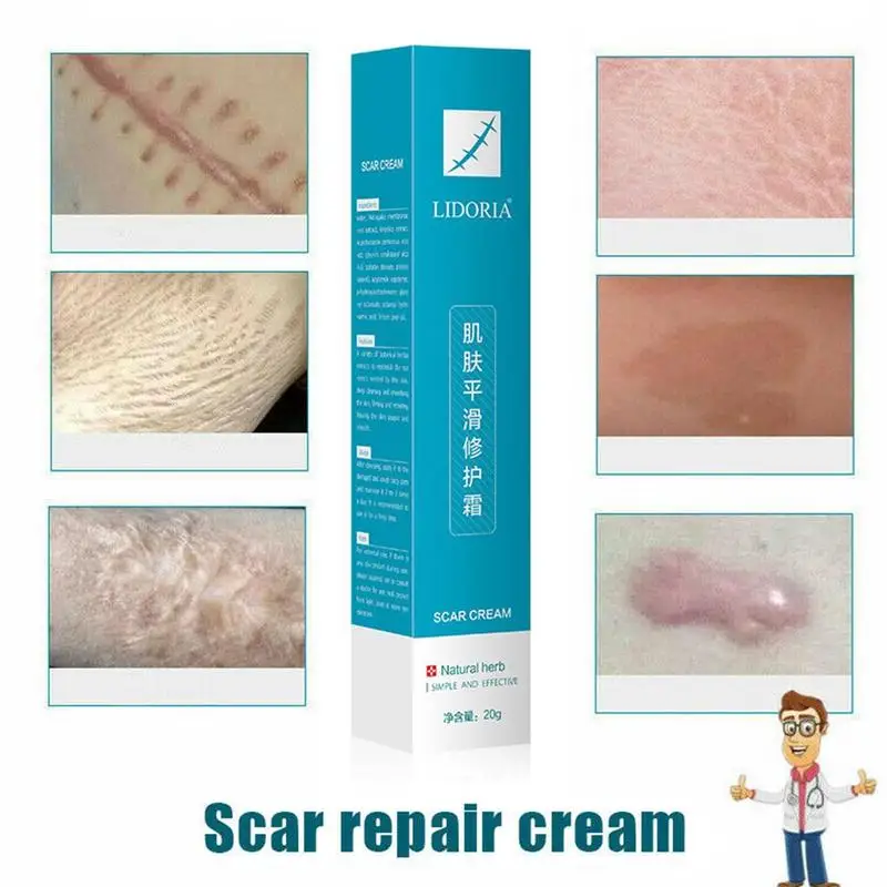 Травяной шрамовый знак удаление кожи тела кремовый дефект уход восстановление