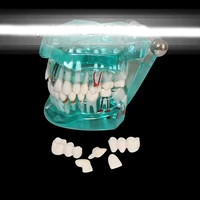 dental pathology model dental caries dental plaque planting tooth model dental implant teaching model free shipping