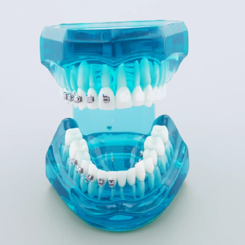 

M3012 Dental Orthodontic Tooth Model with Metal and Ceramic Self-Ligating Brackets