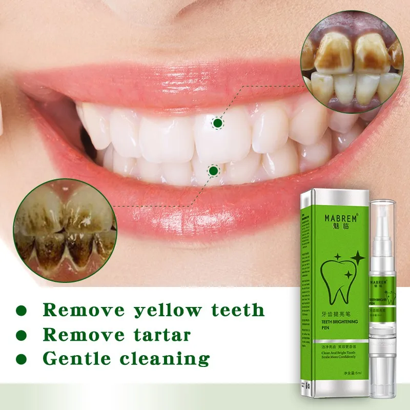 Magic Teeth Whitening Pen Removing Yellow Tooth Cleaning Dazzling White Smile | Красота и здоровье