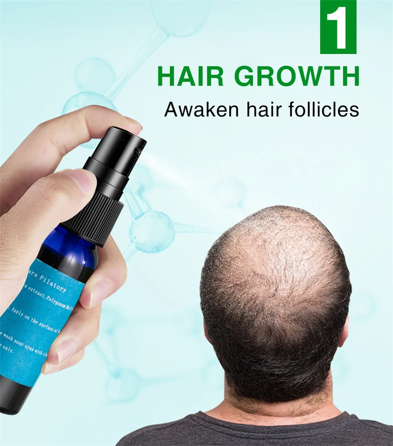 Lanthome Pilatory Sunburst Hair Growth Products For Men Anti Hair Loss Baldness Hair Growth Spray Alopecia Treatment Hair Fall