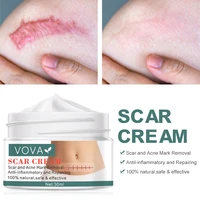 30ml acne scar removal cream pimples stretch marks face gel remove acne smoothing whitening moisturizing body skin care
