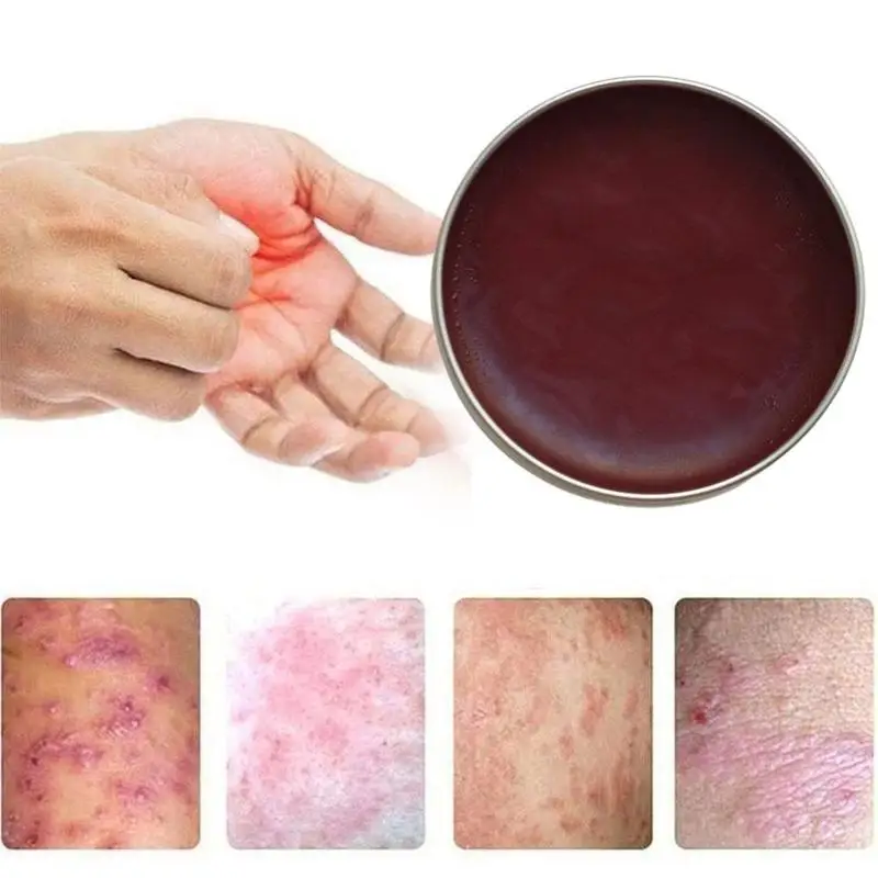 

20g Hip Cream Inner Thigh Whitening Cream Spotless Inner Thigh Spots Remover Fast Action Baby Skin Care Cream Drop Shipping