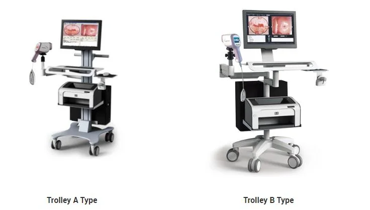 

Digital Colposcope video Endoscope System Electronic Video Colposcope