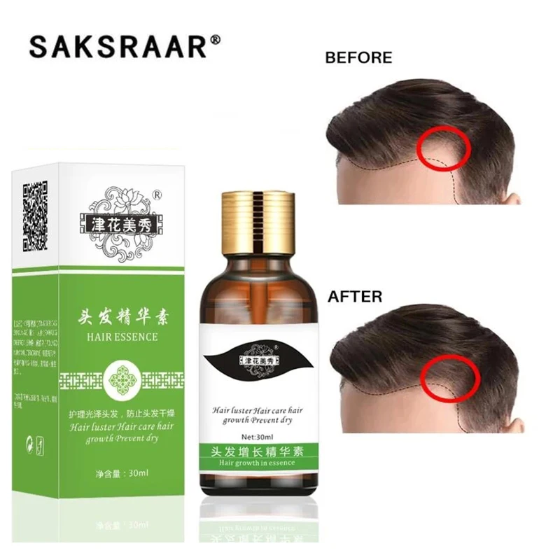 Уход За Волосами Эфирные масла для роста волос эссенция оригинальная Подлинная