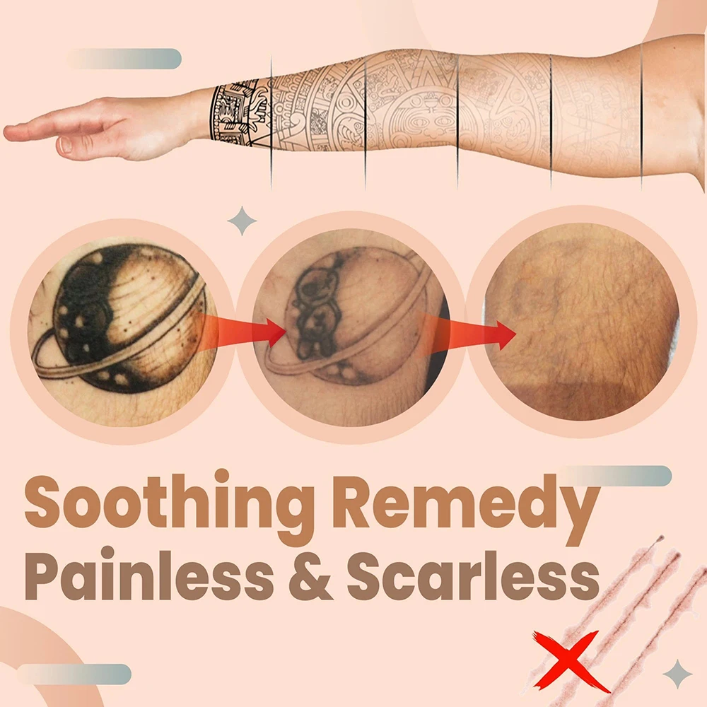 

Pigments Eraser Cream for Tattoo Painless Eyebow Tattoo Remover No Scars GHS99