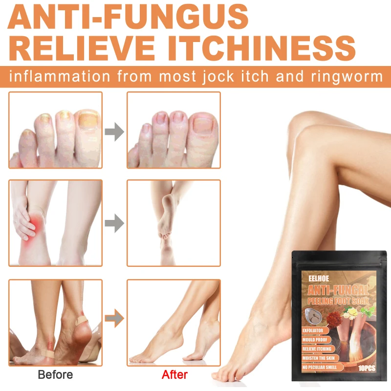 

HOT 2021 Fungal Nail Treatment Detox Foot Soak Long-Term Relief Athlete's Foot Skin Cracking Psoriasis Peeling Beriberi UNISEX
