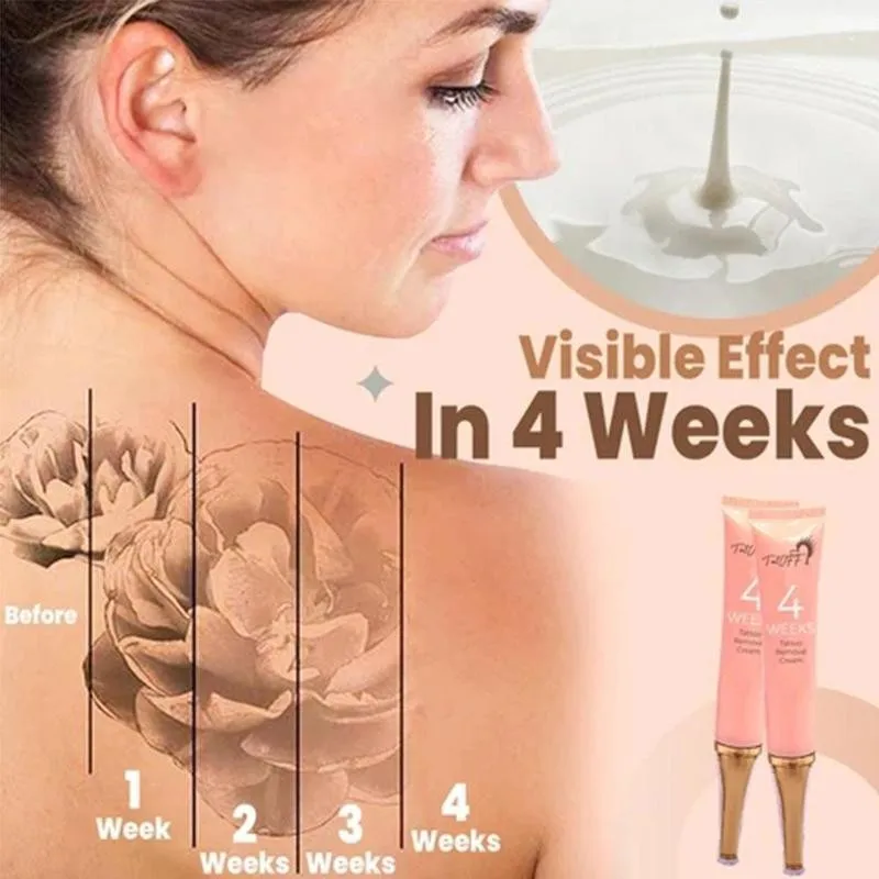 Крем для перманентного удаления татуировок не требует обезболивания