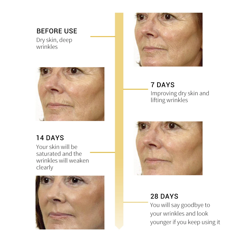 

BREYLEE Retinol Lifting Firming Serum Face Collagen Essence Remove Wrinkle Anti Aging Facial Fade FineLinesRepairingSkinCare17ML