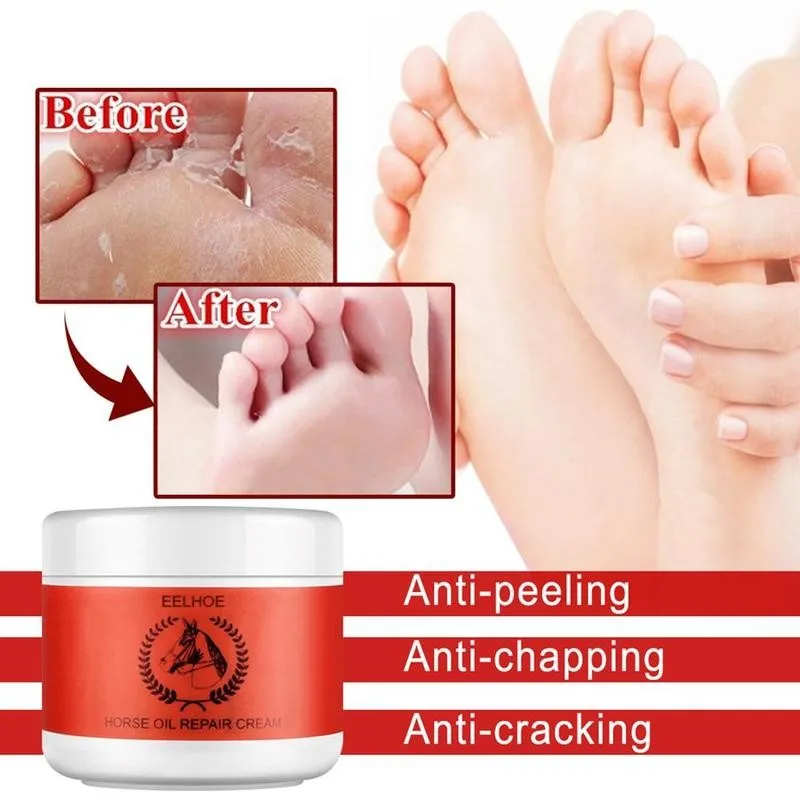 

10 г/30 г/50 г на основе конского жира, питательный крем для ног крем комплект ремонт автомобилей анти-старения зимняя против трещин, отбеливающ...