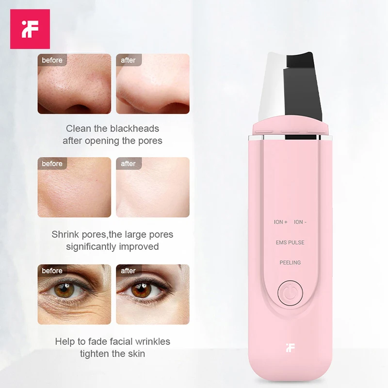 InFace Электрический очищающее средство для лица ультразвукового очищения кожи