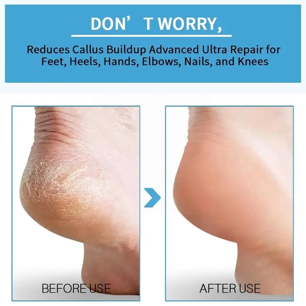 

Противогрибковый спрей для ног, антибактериальный дезодорант для ног, противогрибковый порошок для ног, спрей для пилинга, спрей для пота ...