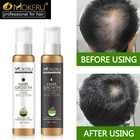 Лосьон Mokeru для восстановления роста волос, натуральное касторовое масло для роста волос, средства от выпадения волос для мужчин, лечение волос, t облысение