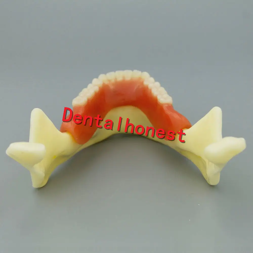 1 шт. Mandible имплантант зубов Модель для стоматологического обучения стоматолога