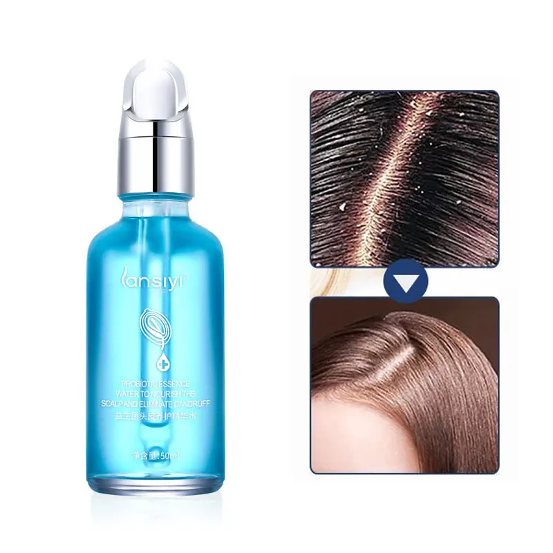 

Hair Treatment Probiotic Dandruff Remover Massage Serum Improve Itchy Head Frizz Scalp Oil Control Repair Hair Care