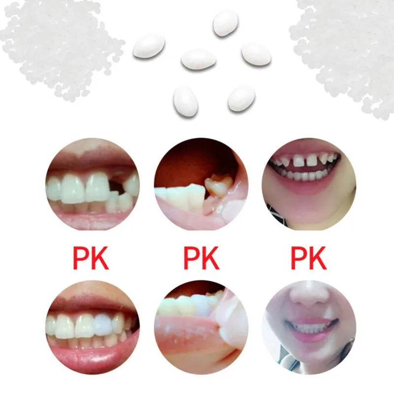 Временный материал для наполнения зубов недостающий инструмент ремонта гигиена