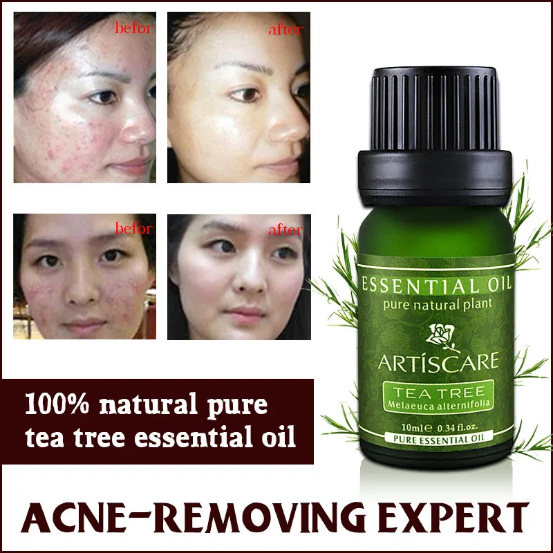 

buy 3 get 1gift powerful acne remover 100% Pure tea tree essential oil for acne treatment and shrink pore skin care tea tree oil