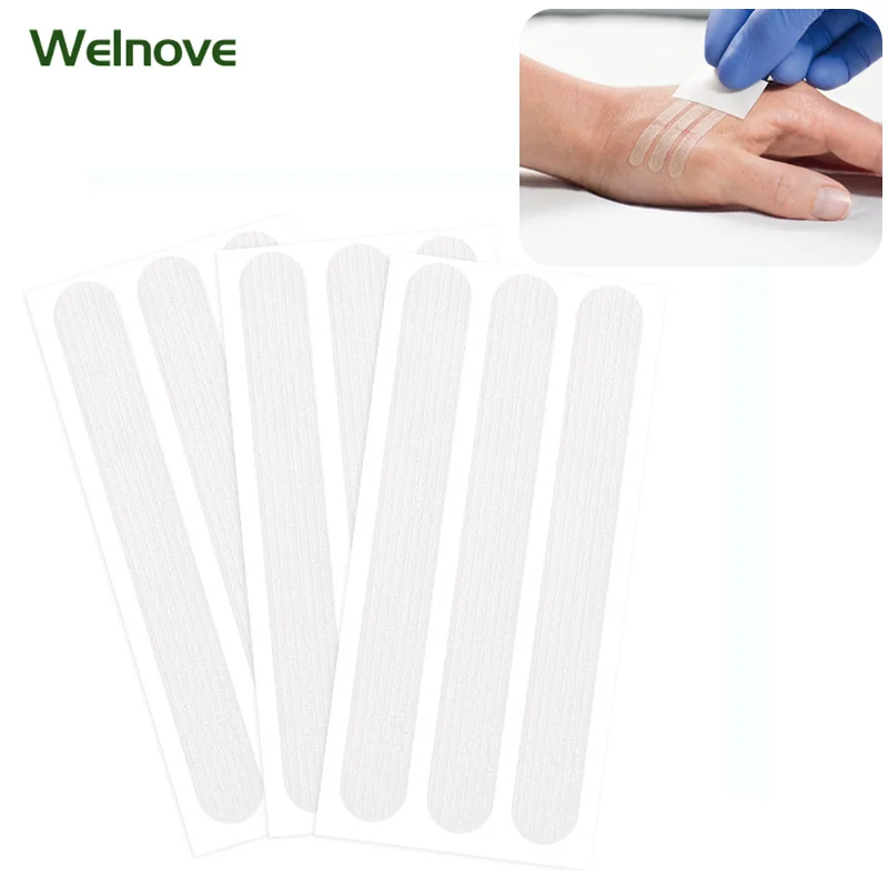 

Wound Skin Closure Strip Medical Surgical Tape No Need to Suture Skin Sterile Wound Dressing Wound Repair Band Aid Emergency Kit