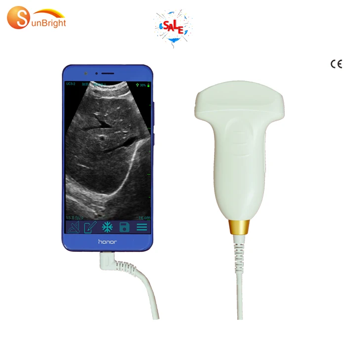 

USB ultrasound USG wireless ultrasound probe connector IOS android mobile scanner device