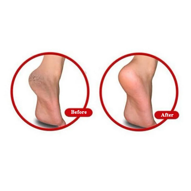 en Ucuz 10 çift Yeni çorap Anti-kırık Tabanlık Ağrı Kesici Jel Nemlendirici çorap Almofada Silikon Topuk Koruyucular Ayak Bakımı Sağlık Bakım